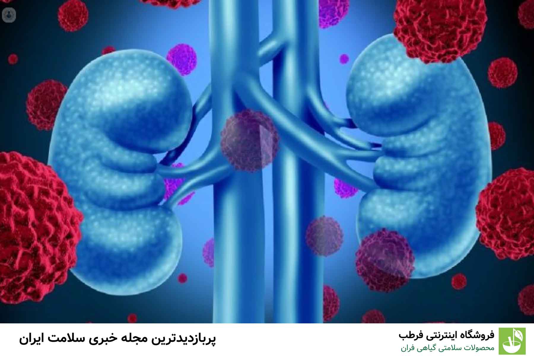 آیا مصرف لیمو برای کلیه مضر است؟