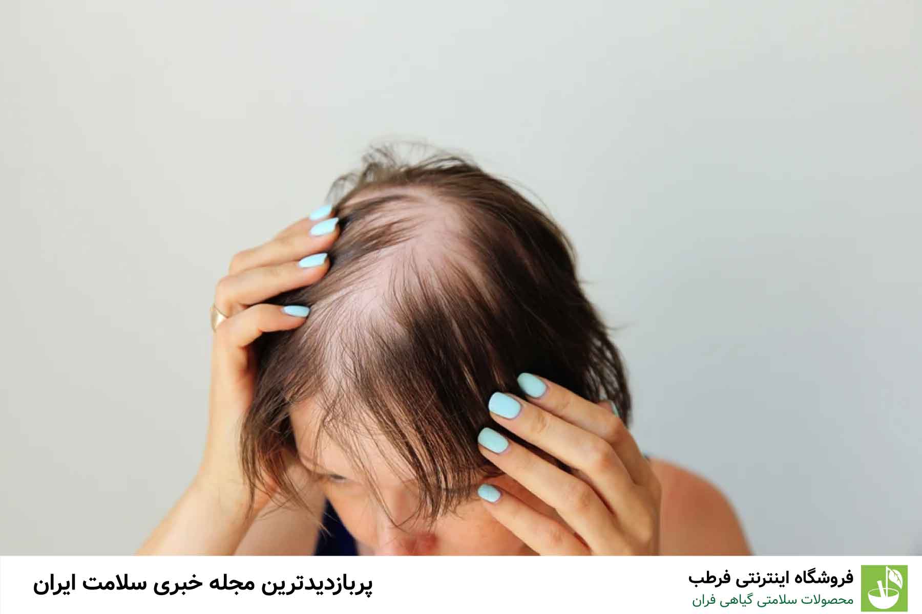 عوامل دیگر موثر بر ریزش مو
