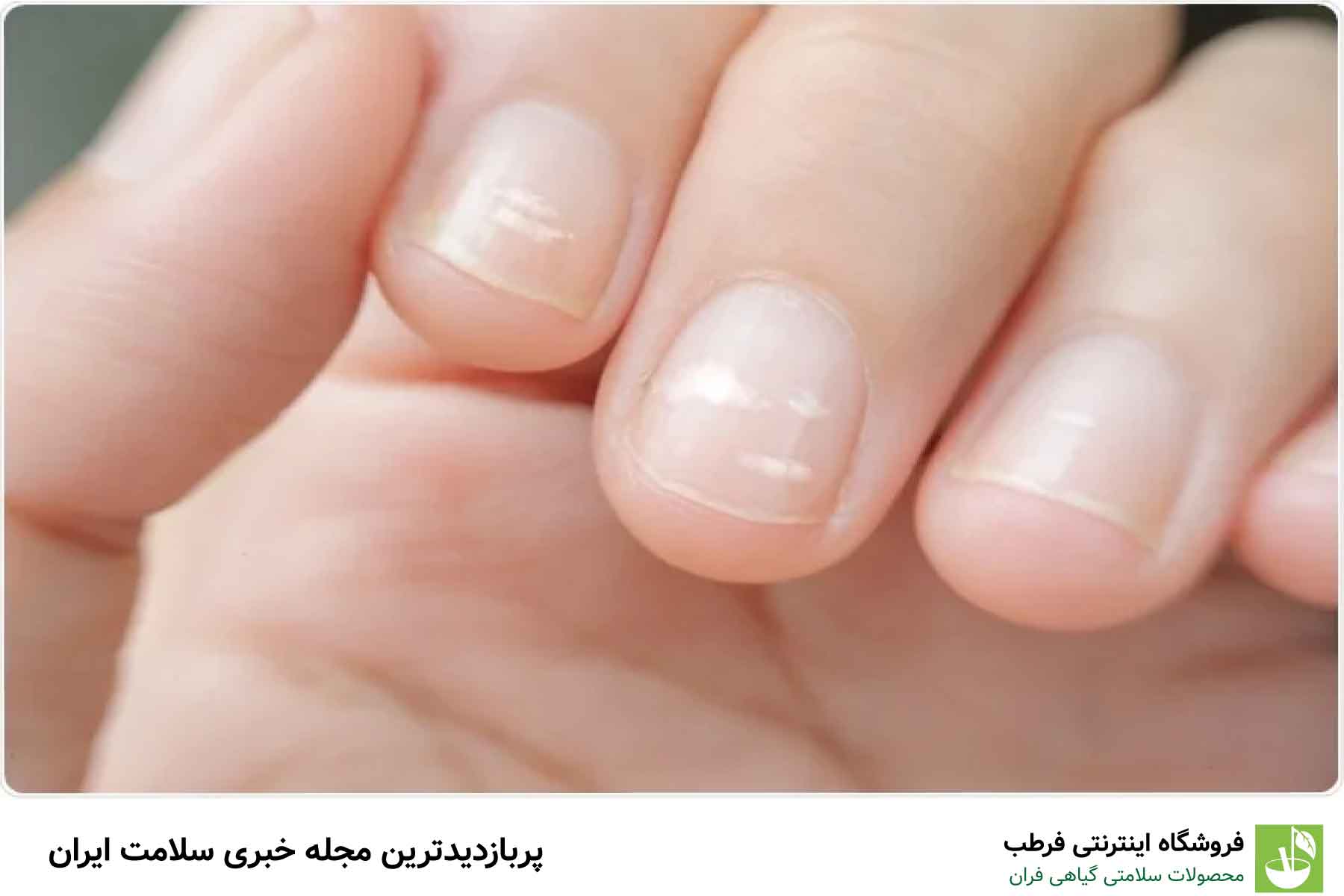 اهمیت مصرف کافی کلسیم
