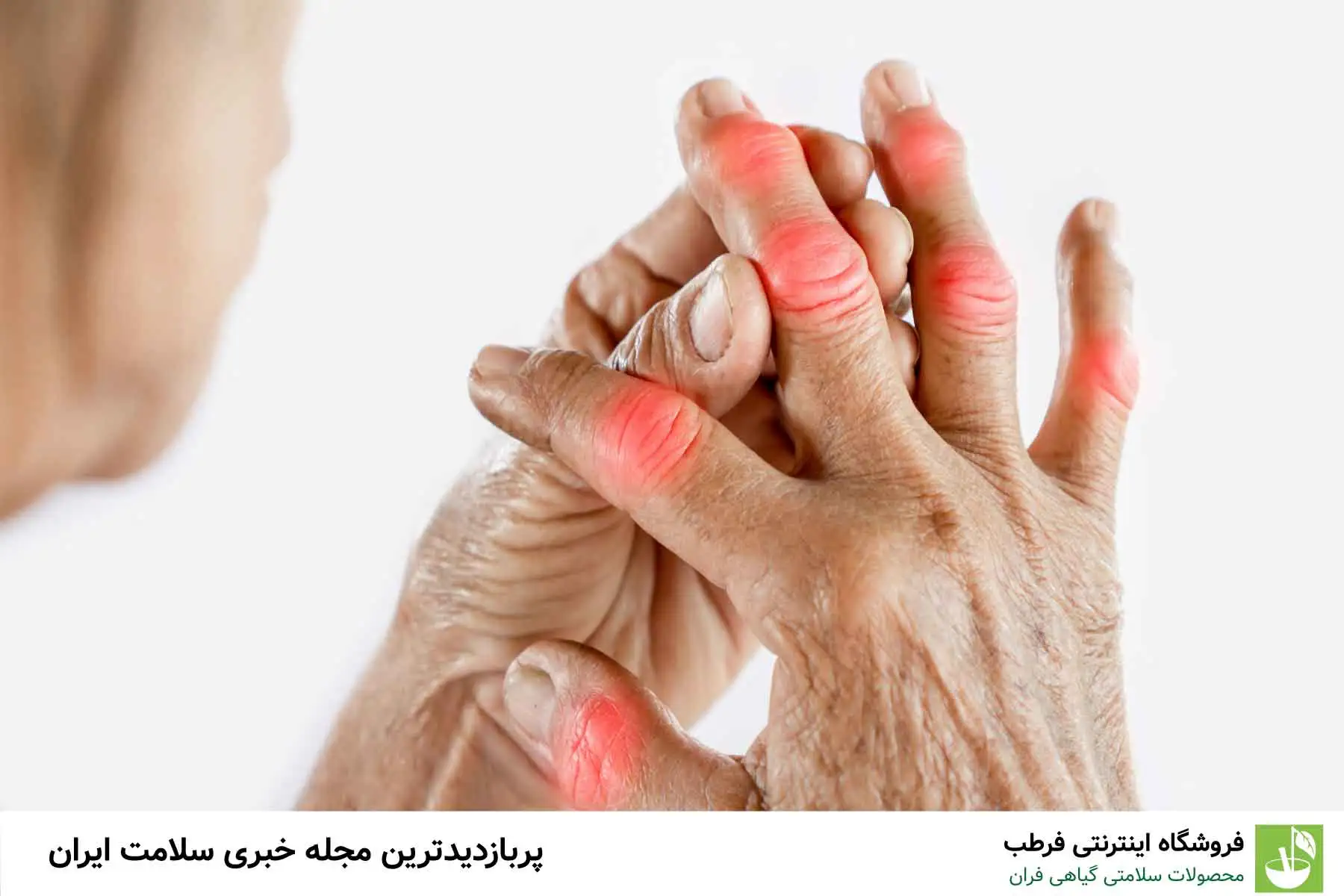 تاثیر سن و چاقی بر بروز آرتروز