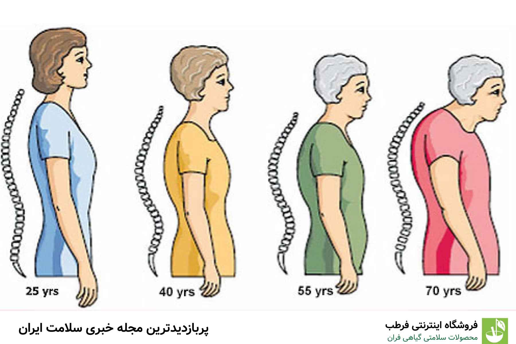 5. افتادگی شانه‌ها یا قوز پشت