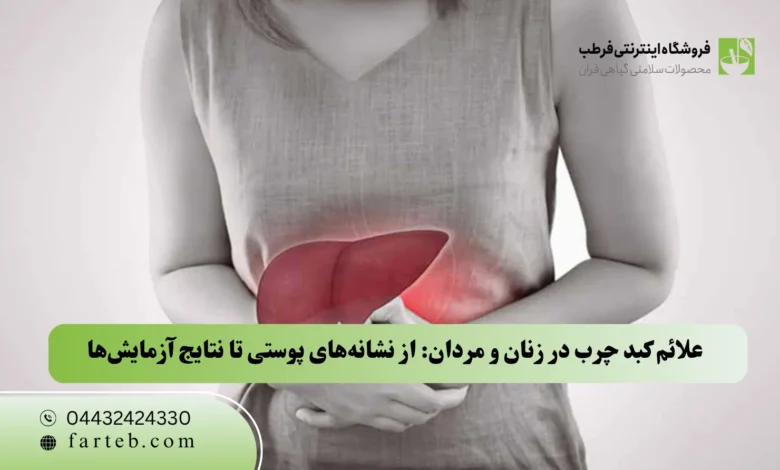 علائم کبد چرب در زنان و مردان: از نشانه‌های پوستی تا نتایج آزمایش‌ها