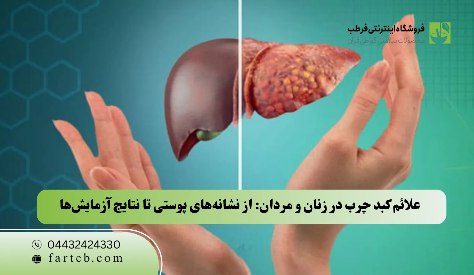 علائم کبد چرب در زنان و مردان: از نشانههای پوستی تا نتایج آزمایشها
