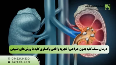 درمان سنگ کلیه بدون جراحی | تجربه واقعی پاکسازی کلیه با روش‌های طبیعی