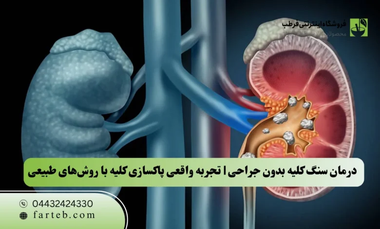 درمان سنگ کلیه بدون جراحی | تجربه واقعی پاکسازی کلیه با روش‌های طبیعی