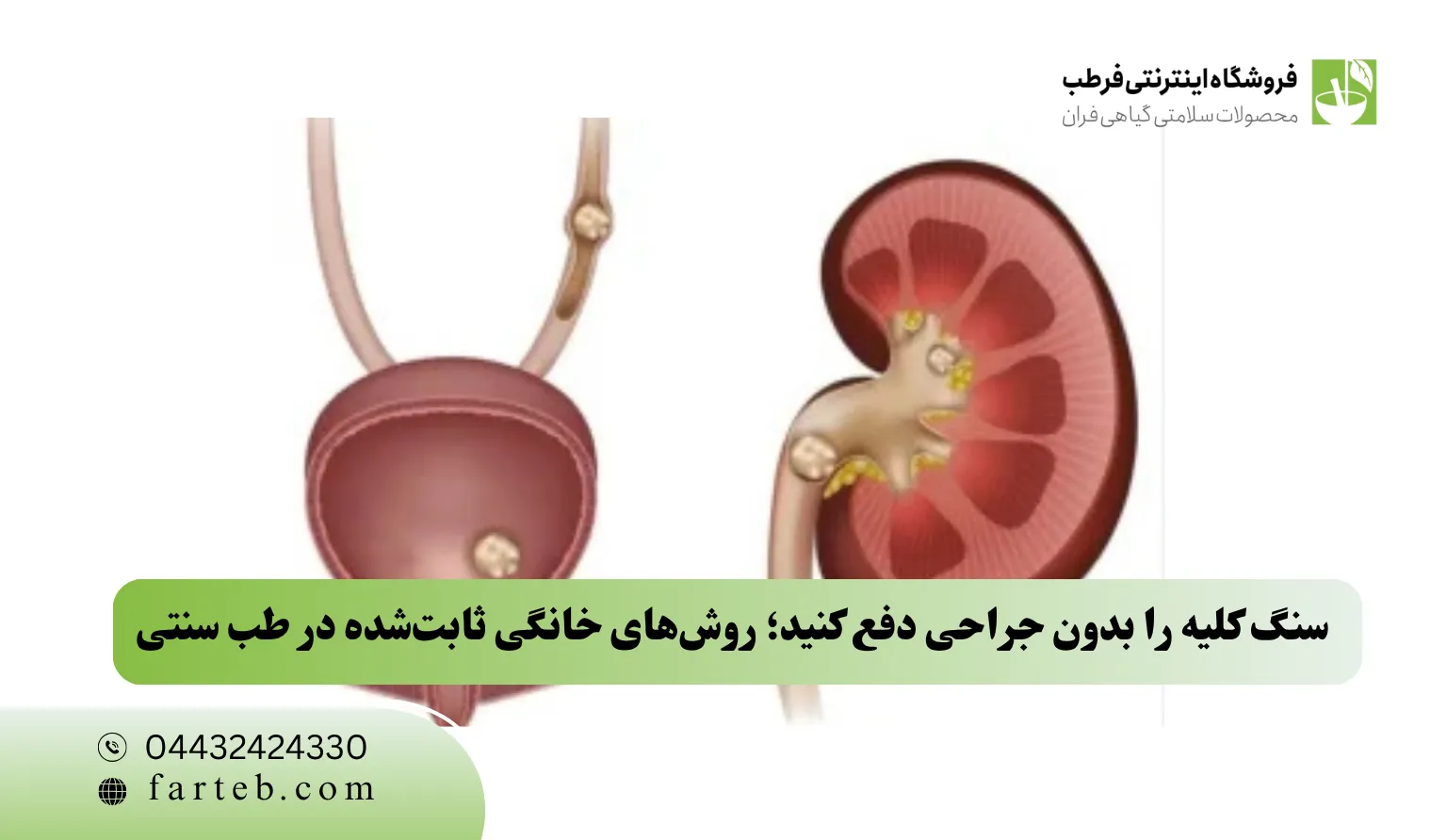 سنگ کلیه را بدون جراحی دفع کنید؛ روش‌های خانگی ثابت‌شده در طب سنتی